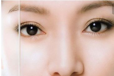 南方醫(yī)院：苗勇種植頭發(fā)的費(fèi)用及效果綜述