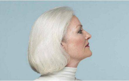 鄭州華領整形醫(yī)院豐胸效果一覽，2023瘦身成功故事詳解