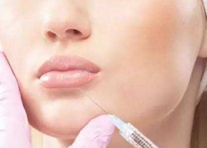 徐占鋒雙眼皮術(shù)后效果如何？專業(yè)醫(yī)生簡介及真實案例分享