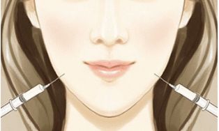 重慶醫(yī)科大學附屬第一醫(yī)院小蠻腰：雙眼皮手術無痛、自然、效果好