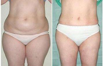 成都優(yōu)質(zhì)醫(yī)生TOP5：尋覓雙眼皮技藝精湛的專(zhuān)家推薦