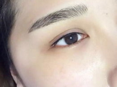 煙臺華怡醫(yī)學(xué)美容院2023年整形套餐的價格如何？