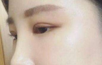 北京民航總醫(yī)院私密整形科的綜合評(píng)價(jià)