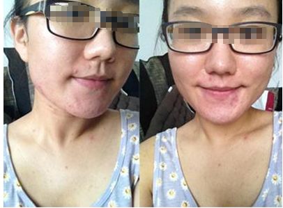 青島眼科醫(yī)院令人信賴的綜合治療