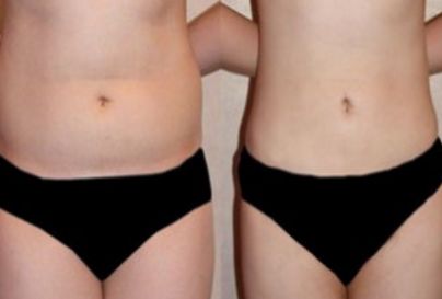 杭州哪家醫(yī)院是顴骨內(nèi)推領(lǐng)域的知名品牌？頂級醫(yī)院排行榜：浙江第一，浙江第二等梳理為參考