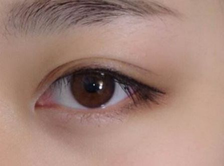 杭州任東做鼻部整容效果如何？MD技術(shù)解析真實(shí)案例分享！