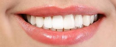 濰坊博雅整形美容醫(yī)院隆鼻案例分享，專業(yè)美容大師為您呈現(xiàn)