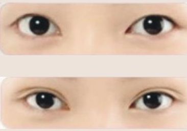 上海星璨整形醫(yī)院，專業(yè)提供驚艷隆鼻技術(shù)，擁有豐富的案例分享