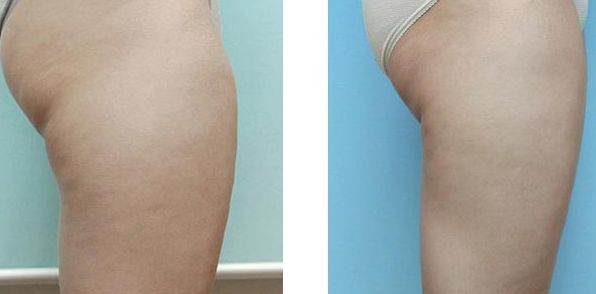 北京優(yōu)質(zhì)整形醫(yī)院鼻子整形排行曝光，醫(yī)療實力揭秘！