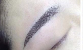 福州弗麗嘉李文信醫(yī)生：鼻部整形經驗分享