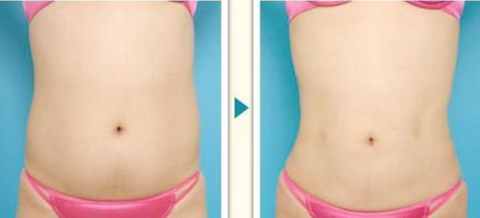 北京最受歡迎的美容院排名前三，熱門醫(yī)院名單不容錯過！