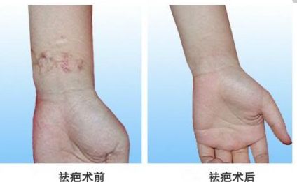 北京自體脂肪隆胸專家真實排行，專業(yè)技術(shù)精粹一同分享