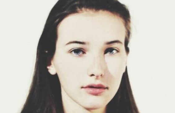 上海九院名醫(yī)許志成幫您輕松解決眼袋問題，真實(shí)案例告訴您效果如何！