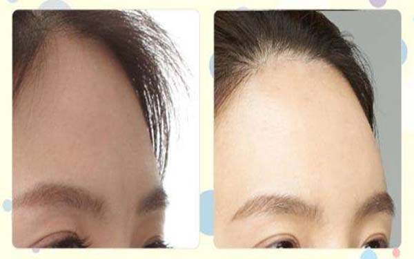 福州哪家醫(yī)院更適合去胎記？如何選擇醫(yī)院進(jìn)行整形手術(shù)？