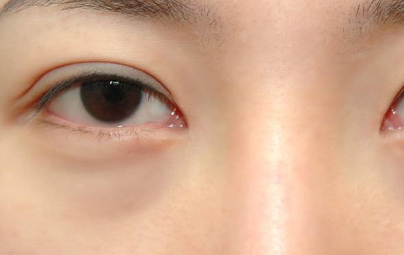 寧波臉部整形領(lǐng)域翹楚！頂尖雙眼皮醫(yī)生大揭秘