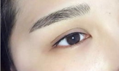 南京施爾美醫(yī)院吸脂效果好不好？南京施爾美醫(yī)院吸脂手術(shù)靠譜嗎？