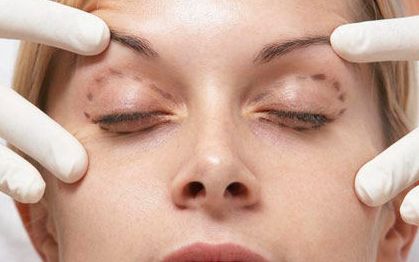 名醫(yī)徐增亮帶你解讀瑞芙臣祛痘技術(shù)，真實案例和價格信息全揭秘！