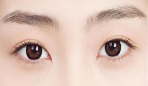 上海九院董繼英醫(yī)生隆鼻案例分享，讓你探尋玻尿酸隆鼻效果如何