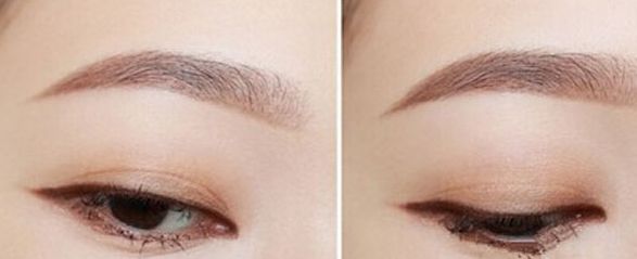 深圳最靠譜的整形美容醫(yī)院推薦，網(wǎng)友大力推薦，不容錯過