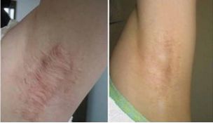 南京哪家醫(yī)院能夠完美實現(xiàn)雙眼皮手術(shù)的期望？