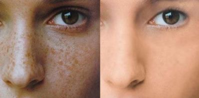 2023汕頭整形醫(yī)院吸脂排行榜及用戶評價(jià)揭曉！