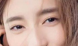 廈門盧藝樸：去眼袋術(shù)后驚艷臉龐，重拾年輕活力，醫(yī)生介紹鼎力推薦