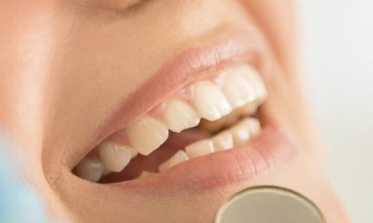 銀川哪家醫(yī)院有專業(yè)的熱瑪吉技術(shù)祛黑眼圈？2023年最新排名出爐，趕緊看看前十名單！