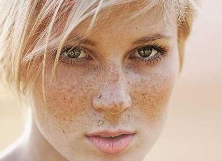 沈陽(yáng)協(xié)和醫(yī)院受歡迎的雙眼皮手術(shù)2023案例分享