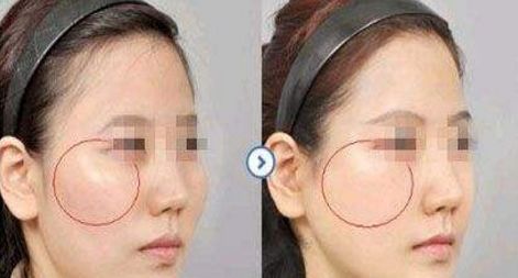 南京明星雙眼皮修復(fù)醫(yī)生排行榜2023，黃金龍、劉育鳳等著名專家入選！