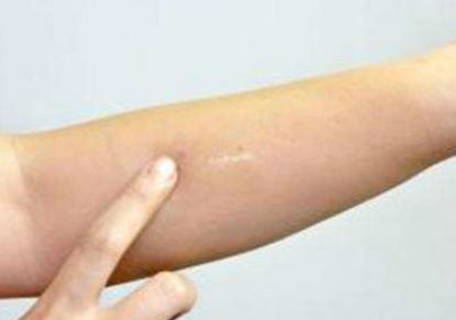 海南省人民醫(yī)院美容科的專家隊(duì)伍及醫(yī)學(xué)背景簡(jiǎn)介