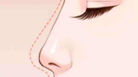 國(guó)內(nèi)整容醫(yī)院哪家值得信賴？面部吸脂推薦選這幾家！公立和私立醫(yī)美機(jī)構(gòu)實(shí)力強(qiáng)勁！