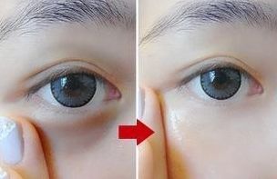 唇部手術(shù)后如何快速恢復(fù)？必須掌握的護(hù)理要點(diǎn)！