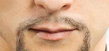 烏魯木齊市有口碑佳的整形醫(yī)院推薦！專業(yè)實力不容錯過！