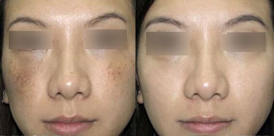 揭秘南京鼻王身份！專家盛贊前五強(qiáng)醫(yī)生，引人入勝！