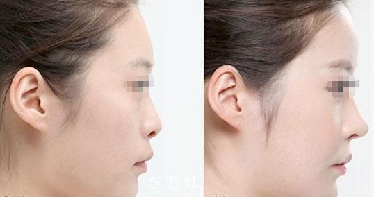 蘇州無線頻率融脂專科醫(yī)生排名前十這幾位醫(yī)術(shù)聲譽(yù)超卓的醫(yī)生是您的不二之選