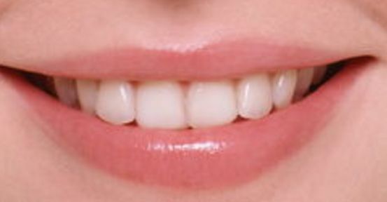 鄭州假體隆胸權(quán)威醫(yī)生推薦名單，值得信賴的選擇