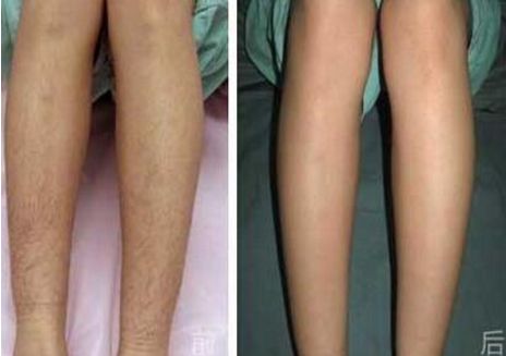 西安整形醫(yī)院：多家權威醫(yī)療機構值得您選擇