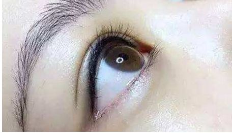 長沙哪位醫(yī)生在雙眼皮修復(fù)技術(shù)上口碑好找排名靠前的？