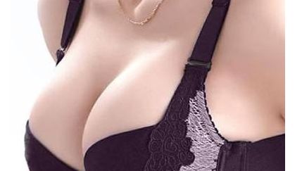 北京王光輝雙眼皮術(shù)后半年感受大揭秘！