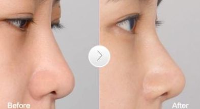 高效祛疤地，推薦的整形醫(yī)院在廣州！更有名口碑榜單盤點(diǎn)