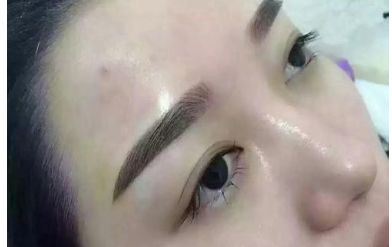 山西二院整形科的醫(yī)生名單更新及熱門項(xiàng)目價(jià)格表分享