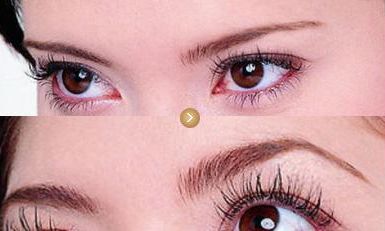 上海眼袋手術(shù)有哪些醫(yī)院推薦？這些醫(yī)療機(jī)構(gòu)醫(yī)術(shù)高超！