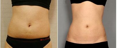 錦州美容整形科專家介紹及收費明細表完善！