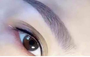 廣州治療內(nèi)眼角凹陷，選擇這幾家醫(yī)院最靠譜