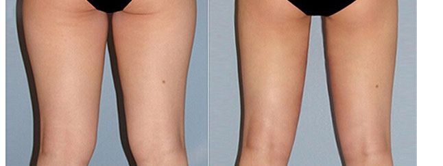 溧陽市眼科專家就診推薦，醫(yī)生名單及治療費(fèi)用一覽