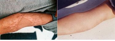 遼寧省近視治療醫(yī)院五佳榜單，這幾家醫(yī)院翹楚地位！