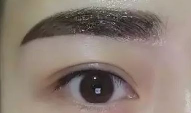 上海瑞格整形醫(yī)院領(lǐng)銜醫(yī)師羅瀾濤——重塑美麗眼睛的魔法使者，成功案例揭秘！