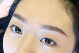 如何優(yōu)雅地?fù)碛须p眼皮？了解專家經(jīng)驗(yàn)與最新案例！