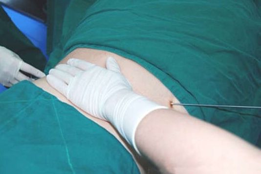 2023山西省五家頂級(jí)整形醫(yī)院推薦