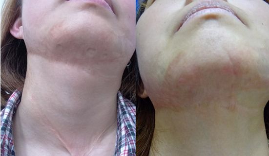 上海九院下頜角整形領(lǐng)域的知名醫(yī)師推薦！名醫(yī)師百人精選！